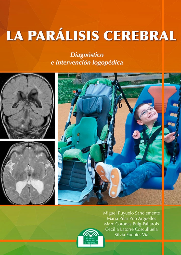 La Parálisis Cerebral Diagnóstico E Intervención Logopédica Miguel Puyuelo Sanclemente Pilar 8324